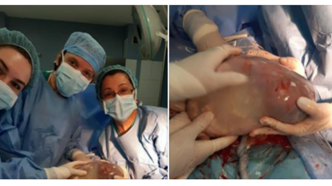 Emocionuese! Në maternitetin e Tiranës lind fëmija…