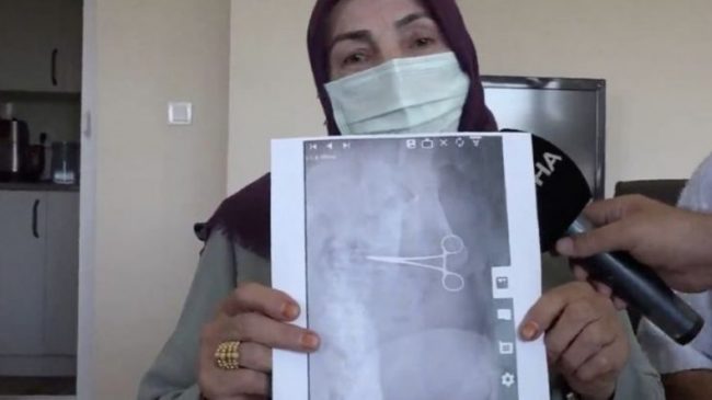 Gruaja në Turqi pëson dhimbje të mëdha…
