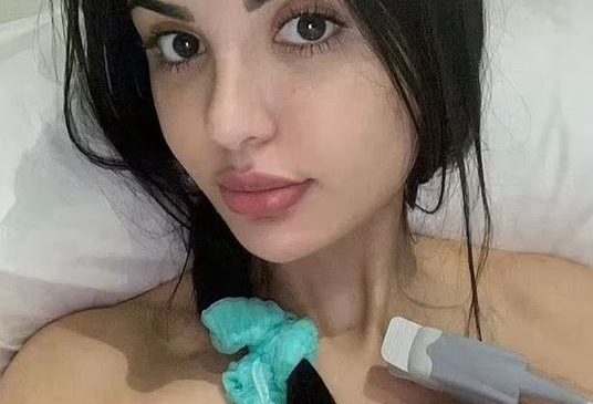 Filleri që injektoi në fytyrë dhe trup&hellip;