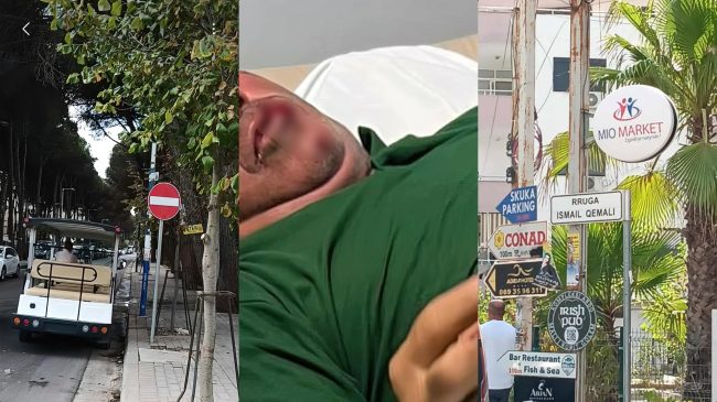“Makina e hoteli në kundravajtje përplasi ‘Xha&hellip;