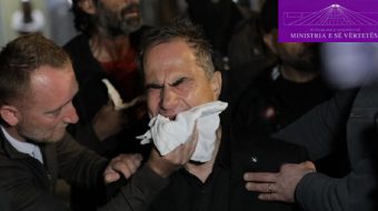 Luçiano Boçi qan me lot për djegien&hellip;