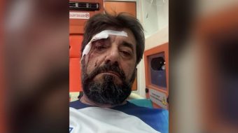 Analisti Ilir Demalia dhunohet nga dy persona&hellip;