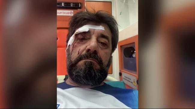 Analisti Ilir Demalia dhunohet nga dy persona&hellip;