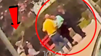 Pamje të rënda: Burri godet me gur&hellip;