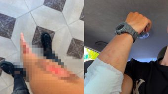 Vaji i derdhur në rrugë i rrezikon&hellip;