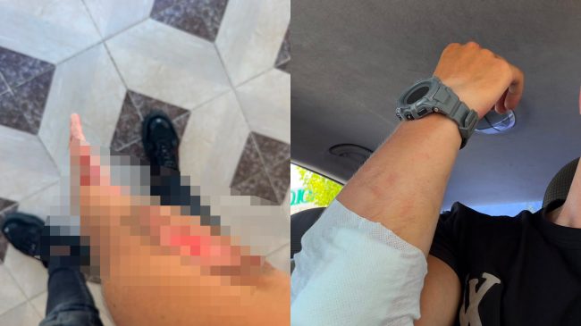 Vaji i derdhur në rrugë i rrezikon&hellip;