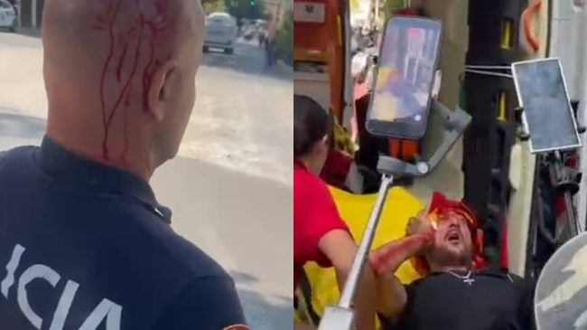 Gaz lotsjellës, ujë dhe sende të forta&hellip;