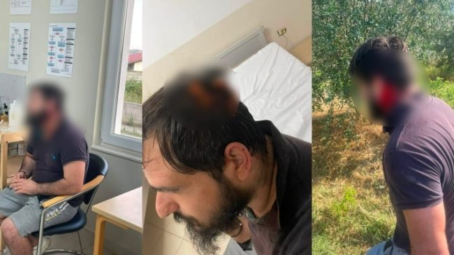 Familja nga Grykëshi i Madh: Fqinjët na&hellip;