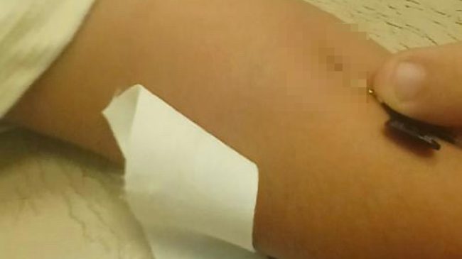 “Viroza dhe fluks i madh: Në spitale&hellip;
