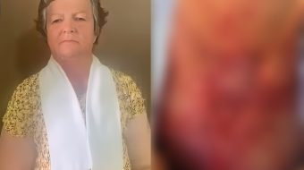 Beteja e Vangjelisë me kancerin dhe varfërinë:&hellip;