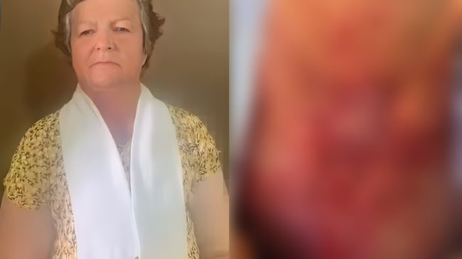 Beteja e Vangjelisë me kancerin dhe varfërinë:&hellip;