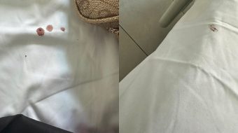 Denoncim nga spitali i Elbasanit: “Çarçafët nuk&hellip;