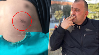 Dhuna në Gramsh, pala tjetër: Loli Çoku&hellip;