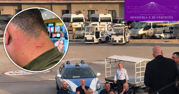 Pas sulmit me thonj nga Rama, qytetari&hellip;