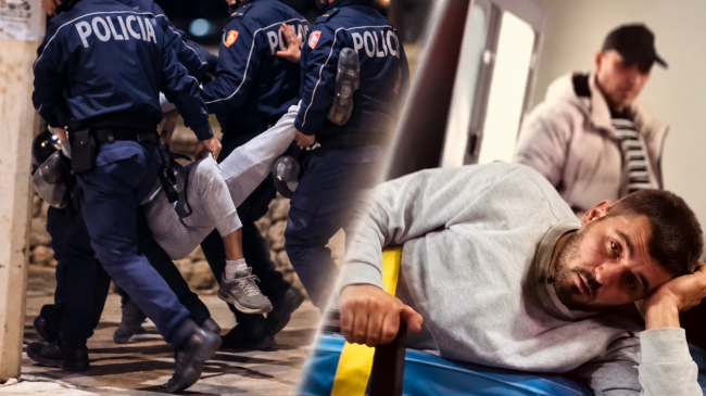 Kushëriri i qytetarit me këmbë të thyer:&hellip;