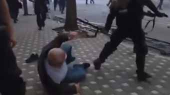 E turpshme: Policia godet me shkop të&hellip;