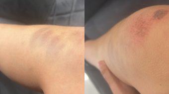 Po kthehej nga shkolla, 13-vjeçari: Policët më&hellip;