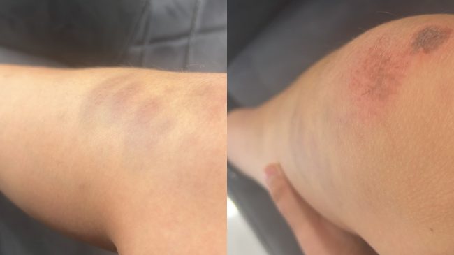 Po kthehej nga shkolla, 13-vjeçari: Policët më&hellip;
