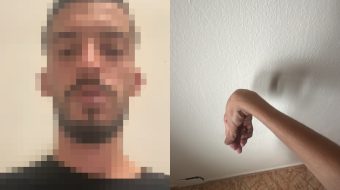 25-vjeçari nga Vora, i paralizuar në krahun&hellip;