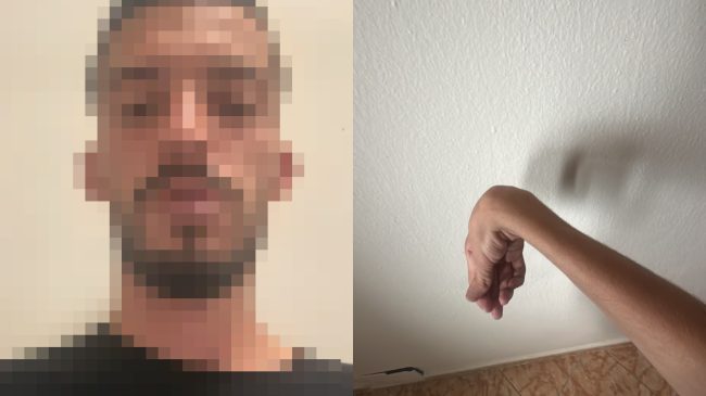 25-vjeçari nga Vora, i paralizuar në krahun&hellip;